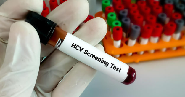HCV Screening Test