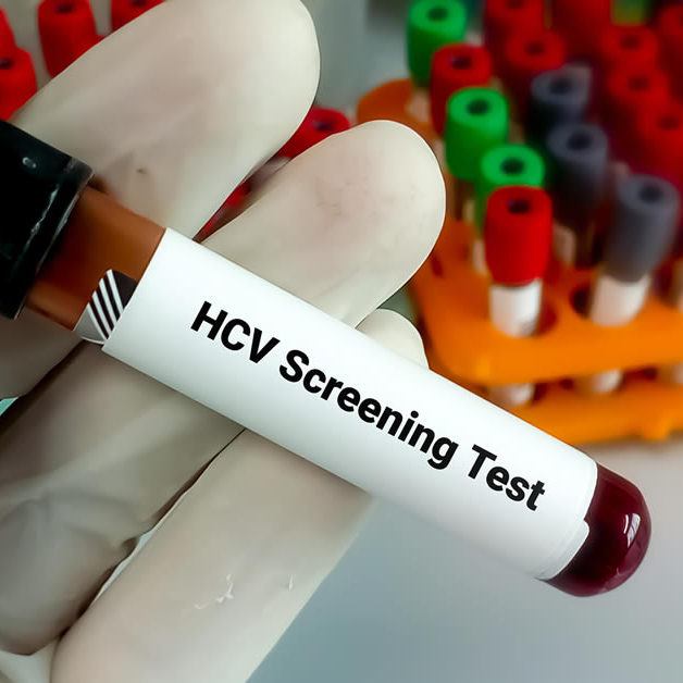 HCV Screening Test
